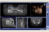Beispiel 4: 3D Röntgen